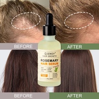 Serum Penumbuh Rambut Label Pribadi Grosir Alami Organik Biotin Beras Rosemary Nutrisi Kulit Kepala Minyak Serum Penumbuh Rambut
