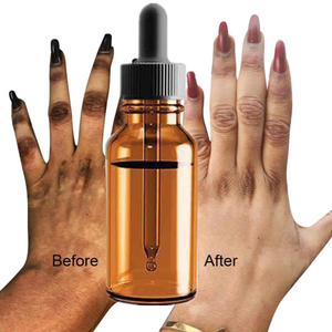 Aceite Exfoliante Amarillo <span class=keywords><strong>Extra</strong></span> Fuerte al por Mayor para Blanquear la Piel y Eliminar Manchas Oscuras en los Nudillos con Su Propia Marca - Product Image 3