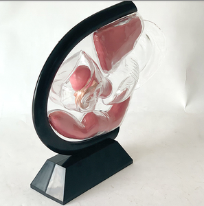 Modelo Anatómico Uterino Transparente Visible, Material Ecológico, Estándar Europeo, Pintura Avanzada No Tóxica, Vic Science Medical - Product Image 5