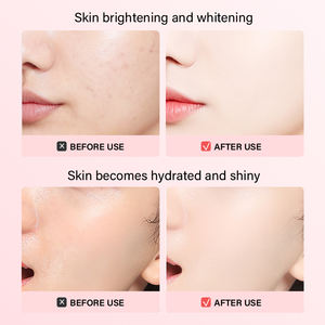 Nicotinamide <span class=keywords><strong>Rose</strong></span> Essence Spray Astringent Toner Protection Solaire Post-Care Pure Herbal <span class=keywords><strong>Rose</strong></span> Hydratant Toner - Product Image 6