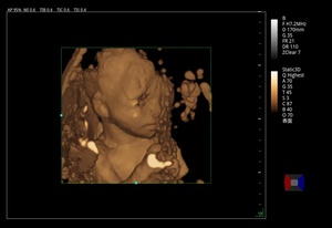 Ecógrafo Veterinario Zoncare Viv 60 con Precio Inmejorable, 3D y 4D, Doppler Color, con Carro, para Hospital Veterinario - Product Image 5