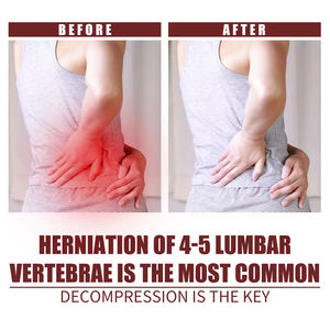 Gel Frío Herbal de 20g para Alivio del Dolor Lumbar, Hernia Discal Cervical, Vitamina E A109, Suministros para el Cuidado de la Salud - Product Image 2