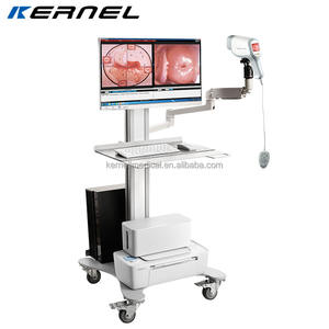 Colposcope vidéo HD professionnel homologué aux États-Unis, caméra vaginale, colposcope optique électronique pour la gynécologie - Product Image 6