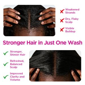 Champú Hidratante y Refrescante con Aceite de Semilla Negra y Cúrcuma WANXI, Reduce la Caspa, Limpia Profundamente y Exfolia el Cuero Cabelludo para Cabello <span class=keywords><strong>Graso</strong></span> - Product Image 5