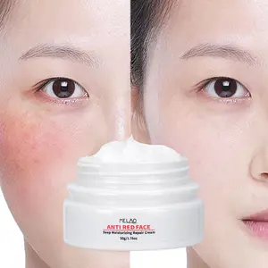 Sensitive Skin Red Calming Redness Rehab Hydrating Skin Care Routine Face Cream Redness Relief