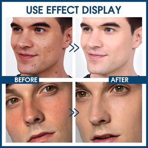 Etichetta privata 50g <span class=keywords><strong>crema</strong></span> idratante idratante antirughe <span class=keywords><strong>crema</strong></span> idratante <span class=keywords><strong>viso</strong></span> da <span class=keywords><strong>uomo</strong></span> - Product Image 4