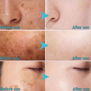 Whitening Serum Voor Gezicht Anti-Donkere Vlekken Gezicht Vochtinbrengende Huid Verheldering <span class=keywords><strong>Nicotinamide</strong></span> Serum Anti Spot Face Serum - Product Image 3