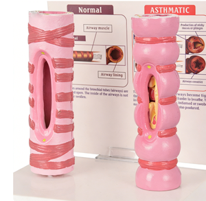 Modè<span class=keywords><strong>le</strong></span> anatomique de trachée humaine pour l'asthme <span class=keywords><strong>et</strong></span> les bronches, avec comparaisons normales <span class=keywords><strong>et</strong></span> pathologiques <span class=keywords><strong>et</strong></span> carte explicative (matériau PVC) - Product Image 2