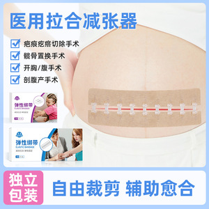 Chen Kang Tension Reducing Patch Transparent Sutureless Zipper Type For Cesarean And Thyroid Surgery Wound Healing - Product Image 5