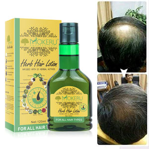 Productos para Acelerar el Crecimiento del <span class=keywords><strong>Cabello</strong></span>, Previenen la <span class=keywords><strong>Caída</strong></span> del <span class=keywords><strong>Cabello</strong></span> y la Calvicie para Mujeres/Hombres con Tipo de Spray - Product Image 3