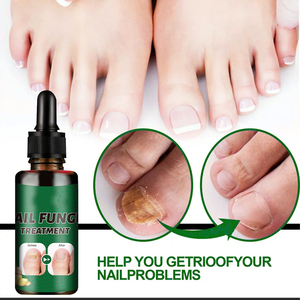 Soins des ongles nourrissants en profondeur, vente en gros, à base de plantes, blanchissant, apaisant, ingrédients contre l'inconfort, <span class=keywords><strong>meilleur</strong></span> <span class=keywords><strong>traitement</strong></span> contre les mycoses des ongles - Product Image 3