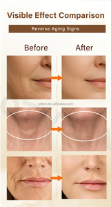오티베나 100% 즉각 효과 인기 상품 즉각 보습 주름 개선 안티에이징 크림 50g - Product Image 5