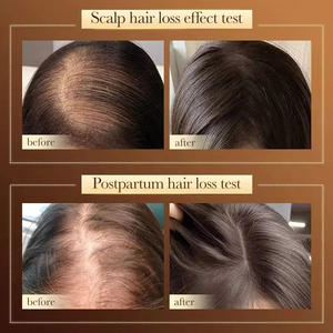 <span class=keywords><strong>Shampoo</strong></span> Secco Idratante e Lisciante, <span class=keywords><strong>Antiforfora</strong></span> e Anticaduta, per Capelli Lisci - Product Image 5