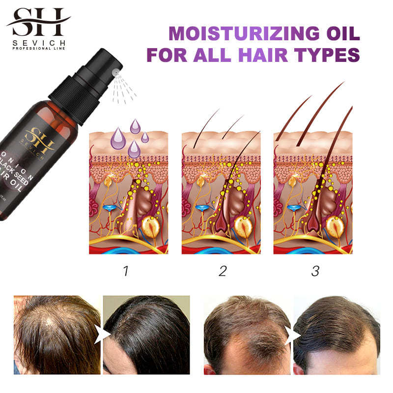 Huile Capillaire Aux Graines Noires D'oignon Pour Faire Pousser Les Cheveux - 60ml - Amueroz - Naturelle - Exp. Décembre 2027