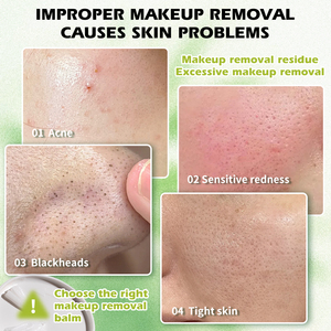 <span class=keywords><strong>Balsamo</strong></span> <span class=keywords><strong>Struccante</strong></span> OEM Coreano per Pulizia Profonda Occhi e Labbra Rimuovi Trucco Cosmetico - Product Image 4