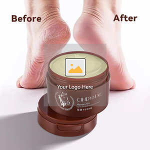 Venta al por mayor <span class=keywords><strong>crema</strong></span> hidratante antigrietas de pies seca reparación <span class=keywords><strong>Urea</strong></span> aceite de caballo manos pies <span class=keywords><strong>Crema</strong></span> <span class=keywords><strong>para</strong></span> el cuidado de los pies paquete personalizado <span class=keywords><strong>crema</strong></span> de maíz de los dedos del pie - Product Image 6