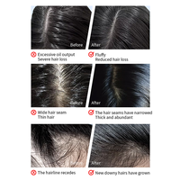 Shampoo capillaire au peptide GHK-Cu, nettoyage en profondeur, contrôle du sébum, traitement rafraîchissant du cuir chevelu, formule nourrissante pour les soins capillaires
