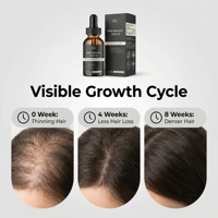 Sérum Capillaire Croissance Peptides Extraits Végétaux Naturels Biotine Caféine Huile de Ricin Nourrissant Cuir Chevelu Sans Prostaglandine Marque Privée OEM