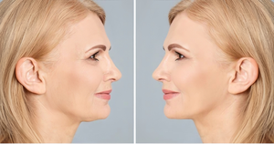 Instrumento de belleza Golden Finger, portátil, con diamante, cinco dedos, mascarilla facial con IA, microcorriente, instrumento de masaje. - Product Image 6