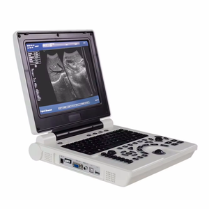 Escáner <span class=keywords><strong>de</strong></span> Ultrasonido Portátil para Animales, con Batería Recargable Integrada, Compatible con Cálculo <span class=keywords><strong>de</strong></span> Edad Gestacional y Peso del Feto - Product Image 1