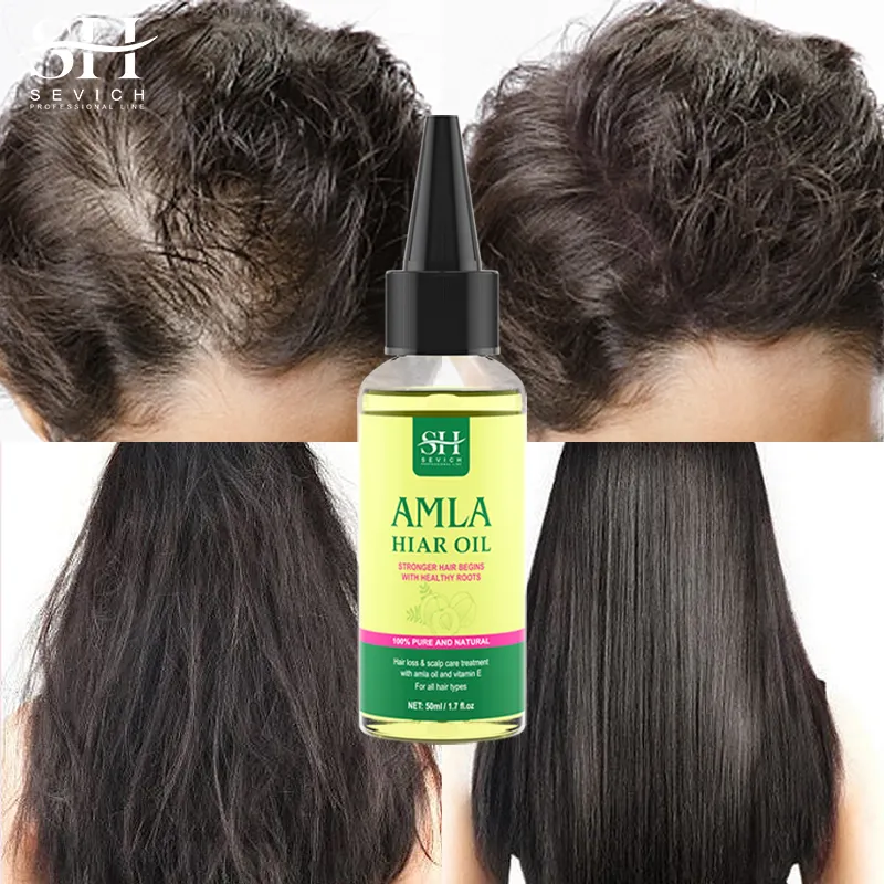 Usine Guangzhou Nouvelle Arrivée Huile de Croissance de Cheveux Amla Biologique Cuir Chevelu Hydraté Indien Amla Hair Herbal Huiles Produits