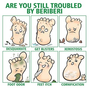 Спрей для ухода за кожей рук и ног, 30 мл - Product Image 3