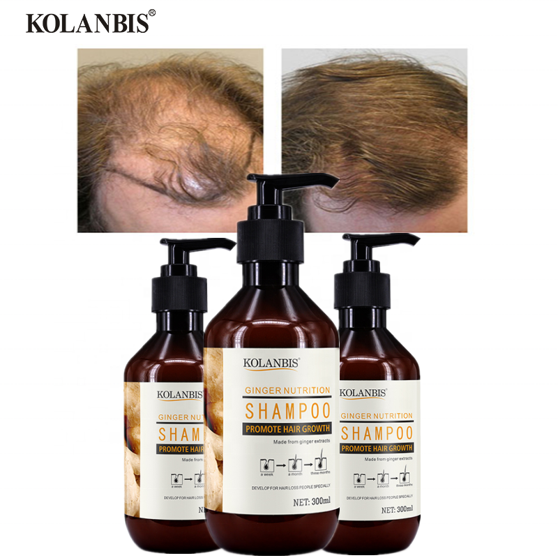KOLANBIS, оптовая продажа, лучший натуральный экстракт корня имбиря, шампунь для роста волос, продукты против выпадения волос