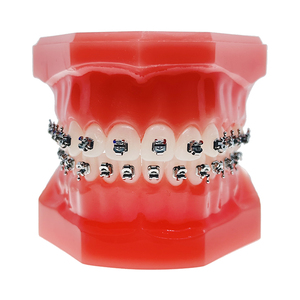 Apparecchio Ortodontico per Raddrizzare i Denti Materiale Dentale Brackets Attivi Roth 2G - Product Image 6