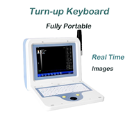Échographe ophtalmique ABS-300 A/B avec sonde 10 MHz, formule IOL, mode immersion/contact pour clinique ophtalmique