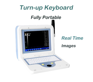 เครื่องอัลตราซาวนด์ตรวจตา ABS-300 A/B พร้อมหัวตรวจ 10MHz, สูตร IOL, โหมด Immersion/Contact สำหรับ<span class=keywords><strong>ค</strong></span>ลินิกจักษุ - Product Image 3