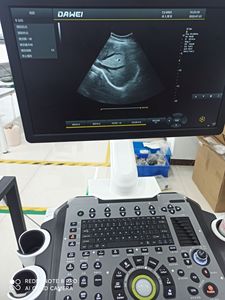 ระบบอัลตราซาวนด์วินิจฉัย Acclarix Lx8 จอ LCD ขนาดใหญ่ 21 นิ้ว แบบหมุนเอียงได้ ความละเอียดสูง ป้องกันแสงสะท้อน - Product Image 6