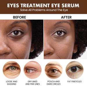 Venta al por mayor de belleza, el mejor cuidado de los ojos, múltiples péptidos, cafeína, antiarrugas, iluminador de ojeras, esencia de suero para los ojos - Product Image 4