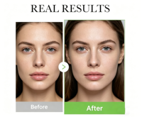 Cosmétique Coréen Madecassoside Crème Acné Collagène Ridules Apaisant Centella Asiatica Gel Crème Riz Centella