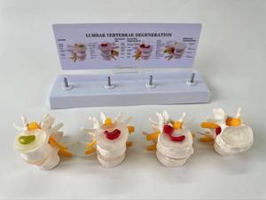 Modello di Colonna Vertebrale Lombare Patologica Umana a 4 Stadi, Modello Realistico di Lesioni della Colonna Lombare, Strumento Didattico Medico - Product Image 4