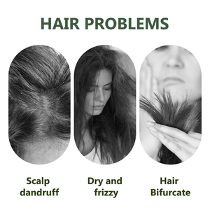 Champú y Acondicionador de Aceite de Árbol de Té con Vitamina C Orgánica OEM de Fábrica, Mascarilla Capilar <span class=keywords><strong>para</strong></span> Limpiar, Controlar la Grasa, Reparar e Hidratar - Product Image 4