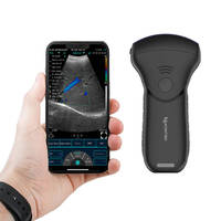 Ультразвуковой аппарат Konted C10MTpro MDR с цветным допплером и беспроводным цветным допплеровским датчиком