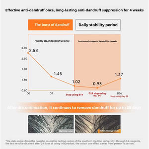 Sampo perawatan ketombe Label pribadi 250ml sampo Selenium sulfida untuk <span class=keywords><strong>Psoriasis</strong></span> dan jamur Malassezia - Product Image 6