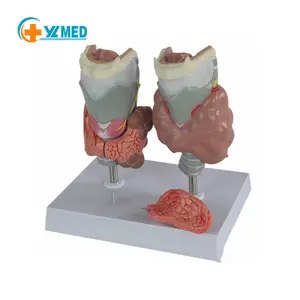 Medical teaching thyroid pathology model Endocrine medicine anatomy thyroid disease display model