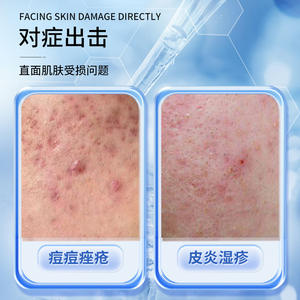 ครีมบำรุงผิวหน้าหนานจิง ตงเรนทัง 15 กรัม สำหรับรักษาสิว ผื่นแพ้ กลาก คัน - Product Image 2