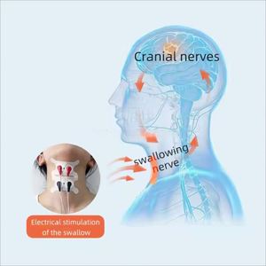 Dispositivo médico no invasivo para trastornos <span class=keywords><strong>de</strong></span> la alimentación, alta calidad, para la deglución, recuperación deteriorada, no invasivo - Product Image 5