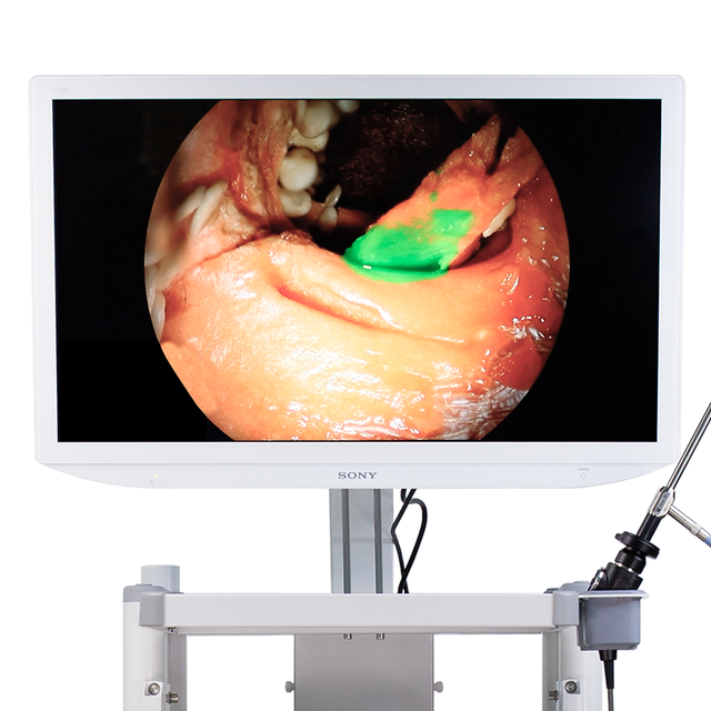 Laparoscopy Tower UHD Endoscope Camera Medical Endoscope Machine Camera System Medical Endoscope System