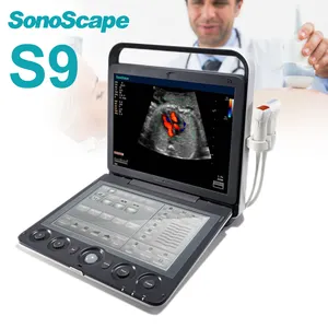 Tıbbi gebelik tarayıcı ultrason taşınabilir renkli Doppler sistemi Sonoscape S9 4D ultrason makinesi fiyat