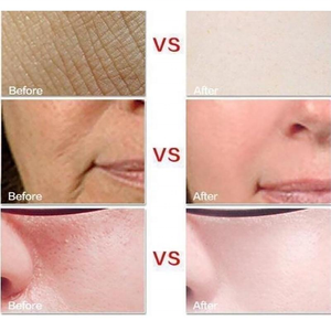 Gel Calmante Bioaqua con 92% de Aloe Vera, <span class=keywords><strong>Crema</strong></span> Facial Hidratante <span class=keywords><strong>para</strong></span> el Cuidado de <span class=keywords><strong>la</strong></span> Piel, Gel Puro de Aloe Vera <span class=keywords><strong>para</strong></span> Hidratar, Reparar y Calmar Después <span class=keywords><strong>del</strong></span> <span class=keywords><strong>Sol</strong></span> - Product Image 3