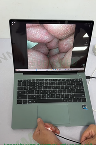 डिजिटल पोर्टेबल लचीला पशु चिकित्सा एंडोस्कोप - Product Image 3