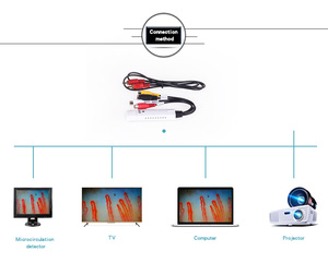 JYTOP yüksek çözünürlüklü büyüteç kan kılcal Nailfold kılcal mikroskobu mikrodolaşım dedektörü - Product Image 6