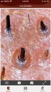 Polarisator Dermatoscoop Trichoscoop Haarscoop Echt 2mp Hd Fro Ios <span class=keywords><strong>Android</strong></span> Wifi Microscoop Met Vervangbare Sproeiers - Product Image 5