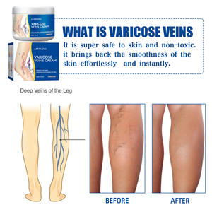 Krim pereda flebitis dan vaskulitis, buka blokir pembuluh, mengobati halus, pereda varises untuk kaki dan pereda nyeri punggung - Product Image 3