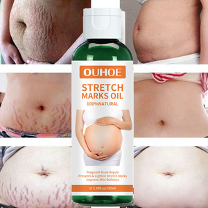 Aceite OUHOE para Eliminar Estrías, Reparación y Eliminación de Cicatrices de Embarazo y Estrías, Cuidado Confortable, Venta al por Mayor, 100 ml - Product Image 1