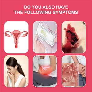 Gel bacteriostático íntimo femenino OEM: reduce y alivia la <span class=keywords><strong>vaginosis</strong></span> bacteriana y alivia la sensación de ardor vulvar - Product Image 2