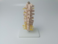 Modelo Anatómico Humano de Columna Vertebral con Vértebras Lumbares, Sacro y Coxis, y Hernia Discal, Tamaño Real, para Enseñanza Médica